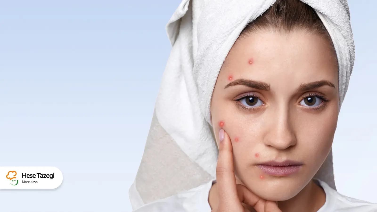 غذاهای مفید برای آکنه و جوش صورت و بدن